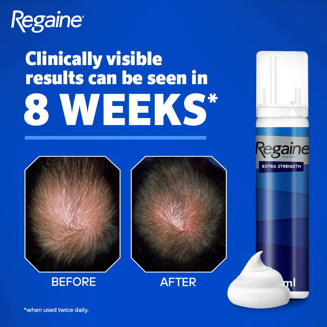 Regaine Men's Foam 60 ml